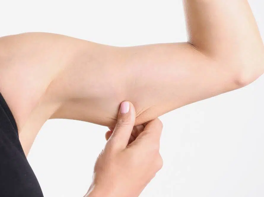 exc.beauty-chirurgie 2-oberarmlift